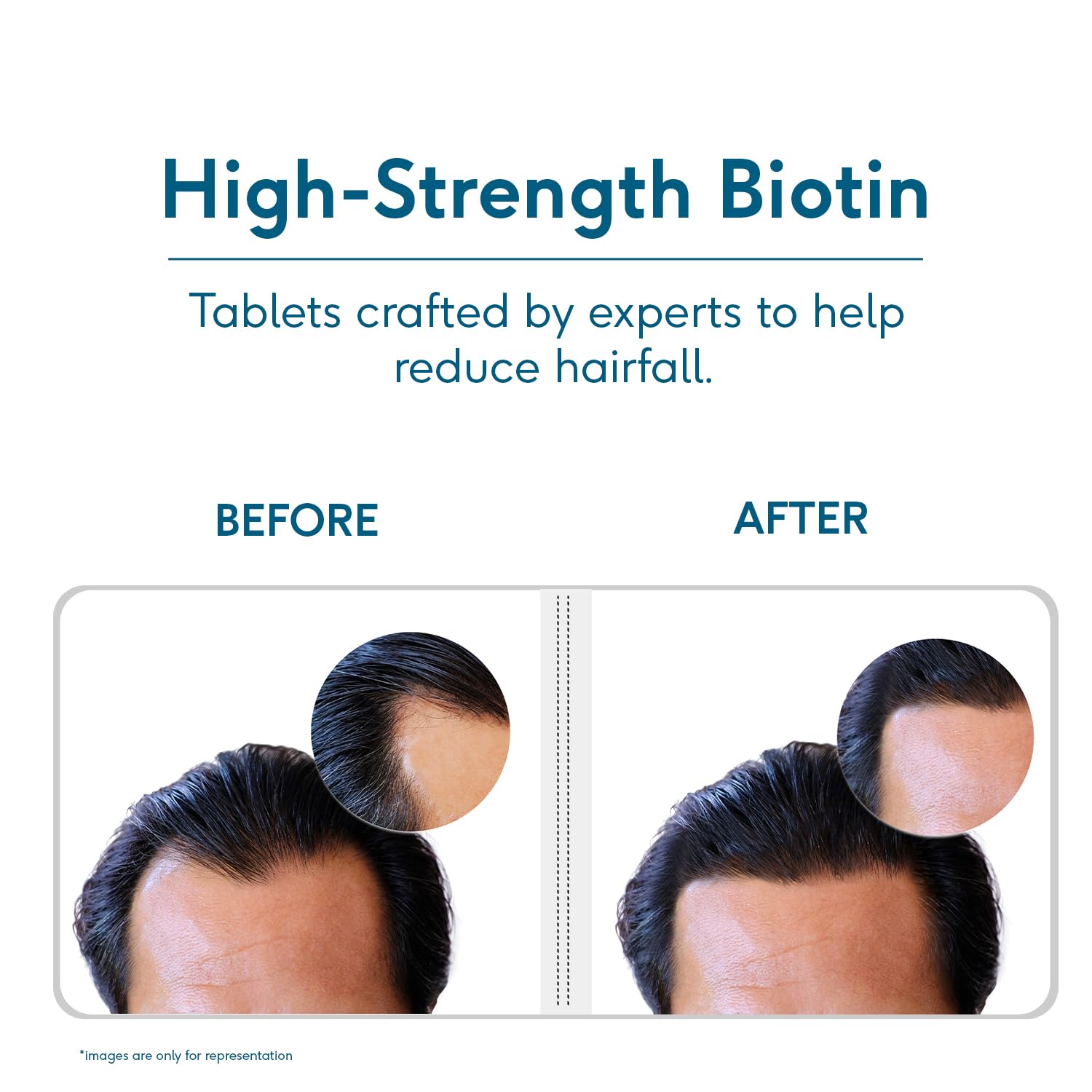 HK Vitals Biotin, Supplement for Hair Growth, Strong Hair and Glowing Skin, Fights Nail Brittleness, Biotin Tablets